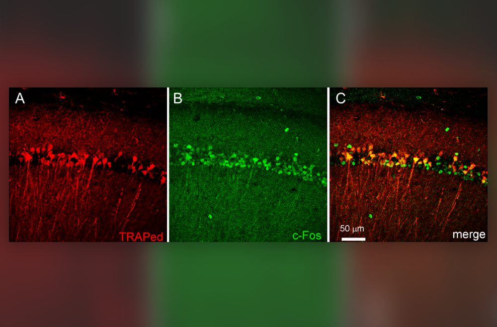 Early life seizure-associated neurons (A, red cells) are preferentially re-activated by later life seizures (B, green cells; C, combined).